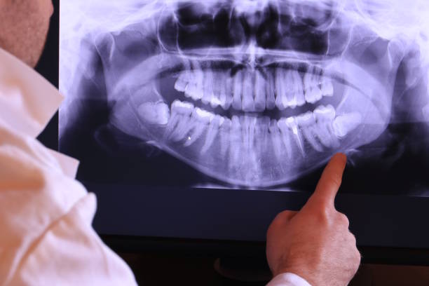Best Dentist for Tooth Abscess  in New Iberia, LA